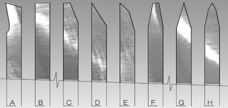 image of the shape of teeth